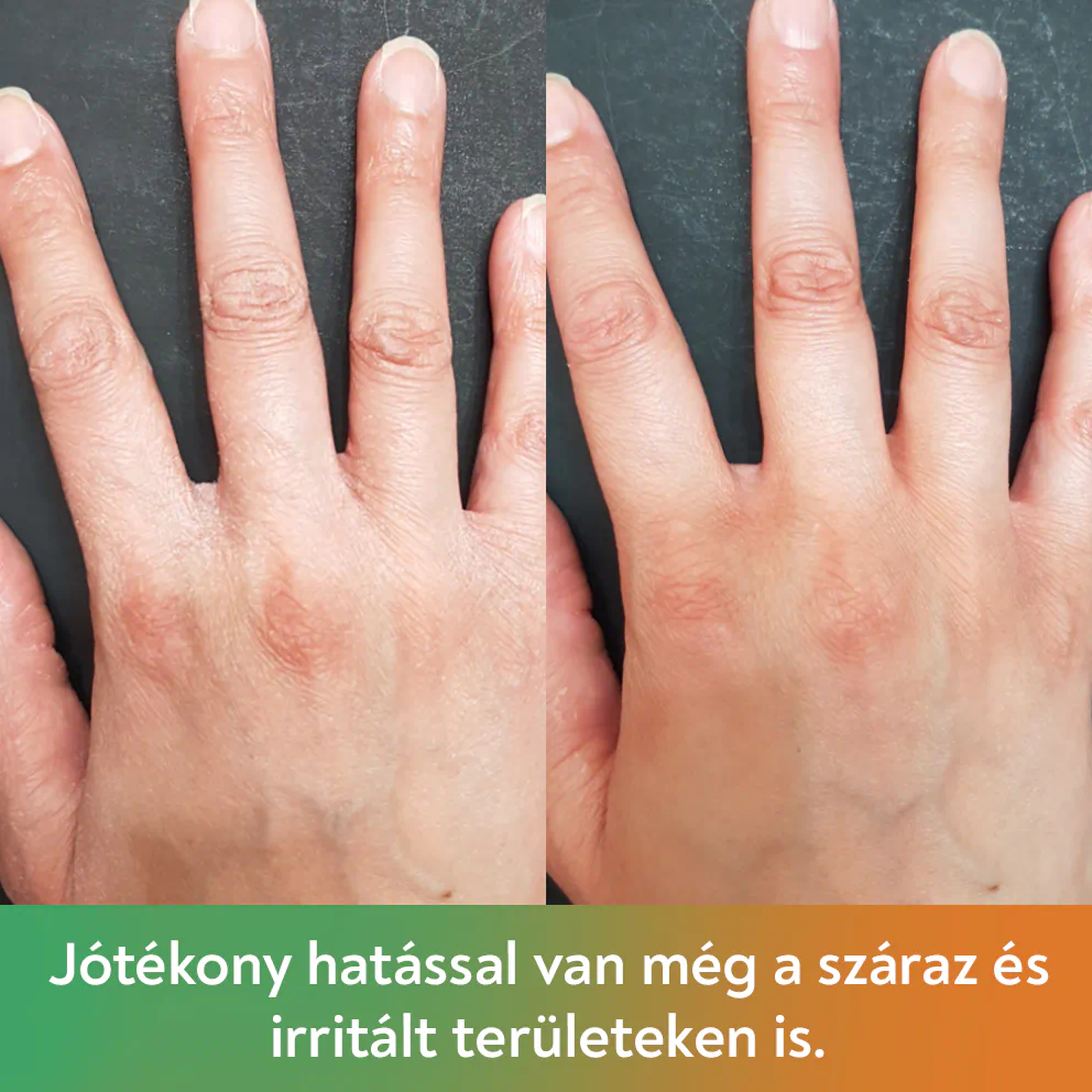 Urea és kamilla kézkrém