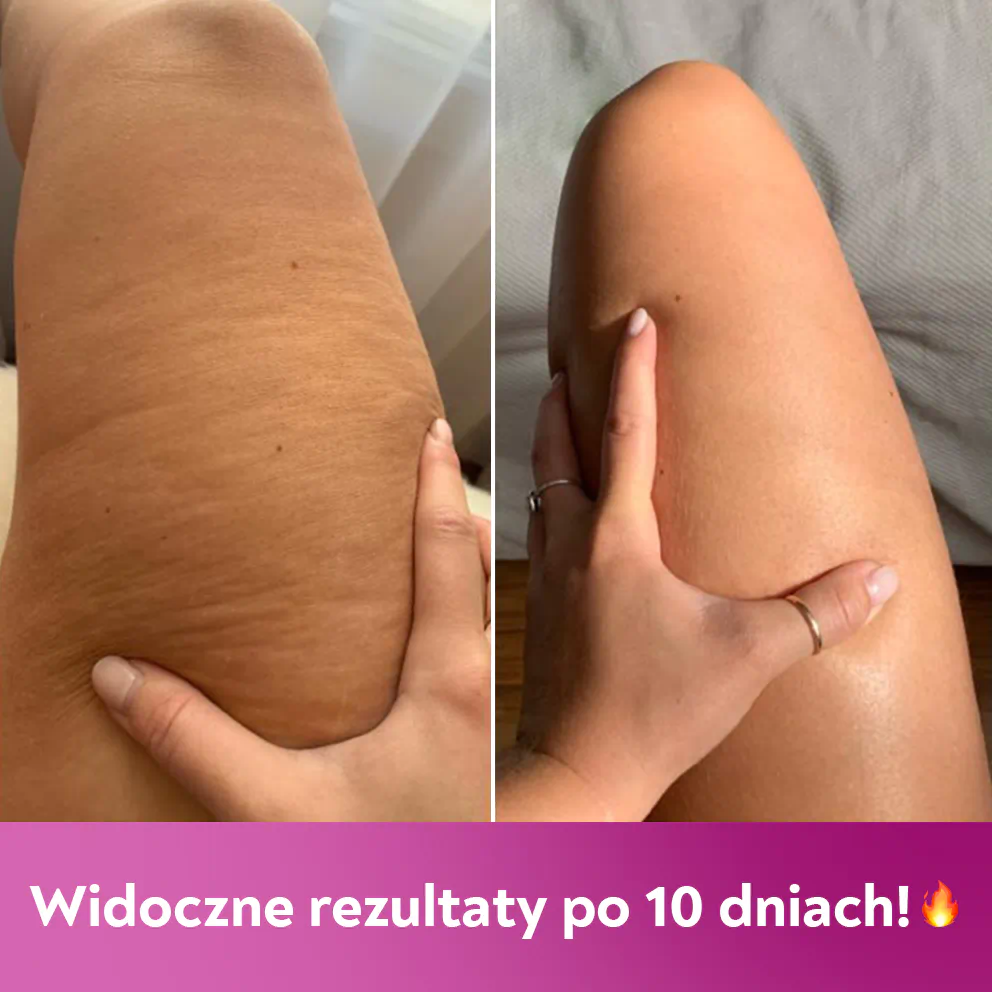 Krem antycellulitowy z ostrej papryczki 