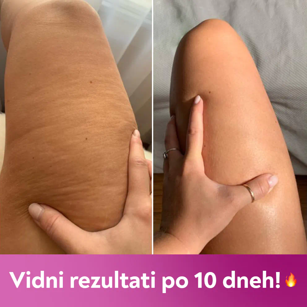 Krema proti celulitu s feferonom 