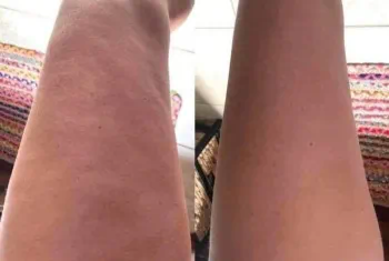 Γιώτα Βασιλάκου