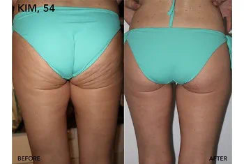 Τσαλεμη Ευτυχία