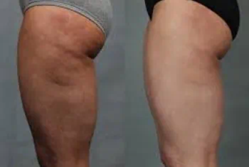 Νίκη Ανδρέου