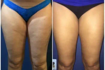 Παμ Τσαούσης